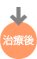 治療後