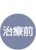 治療前